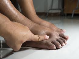 Image result for toe black diabetes