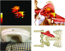 Figuring out what's causing your back pain might help you pick the right treatment. Magnetic Image Of Pain Source In Back Muscles Upper Left Functional Download Scientific Diagram