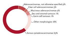 Ovarian cancer is a type of cancer that forms in ovarian tissues. Krebs Ovarian Cancer