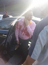 Bu 8,1 km'lik (5,0 mil) otoban kuzeydeki kuala lumpur'u seremban, negeri sembilan güneyde. This Man Cheated Death After Getting Shot 5 Times At The Kl Seremban Highway