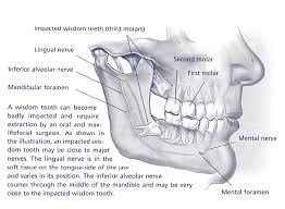 How do you get rid of numbness after tooth extraction? General Information Oms Specialists