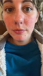 🔥🐲🐉 Found this guy in another group and knew he belonged here. 🌳💚