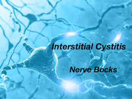 Image result for Interstitial Cystitis