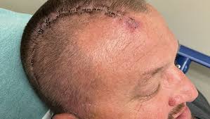 Fundraiser for Austin Herion by Tisha Turman : Help Austin's Fight with  Brain Cancer