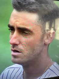 Yankees Base Running and Coaching Issues