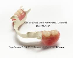 Our fees for the polymer metal free partial denture is $2400 and the flexible partial denture is $1500. Metal Free Partial Dentures Sedona Cottonwood Az