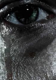 Vermicularis, or pinworm, causes irritation and sleep disturbances. Ocular Parasitic Infections An Overview Intechopen