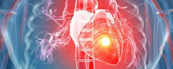 Miocarditis es una dolencia caracterizada por la inflamación del músculo cardíaco. Desarrollan Nuevo Tratamiento Para La Miocarditis Cluster Salud Americaeconomia