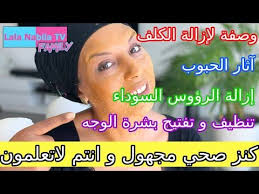 تبييض الوجه تبييض الرقبة إزالة الكلف و آثار الحبوب تنظيف و تفتيح بشرة الوجه بمكون سوف يدهشك Youtube Incoming Call Screenshot