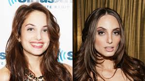 Celebrity Plastic Surgery 30 Before After Pics Stylecaster