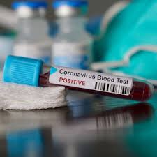 Covid 19 Testing In 15 Minutes Healthmanagement Org