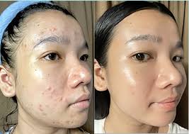 Motivation tips? Many thanks xo