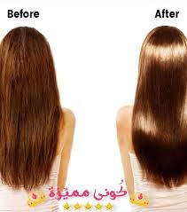 Botox Injection حقن البوتوكس علاج التجاعيد علاج الشعر بالبوتوكس Long Hair Styles Hair Botox Injections