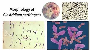 Clostridium is a group of 80+ bacteria that could have potentially harmful effects on your body as they reside in your digestive system (woeller, 2015b). Clostridium Perfringens An Overview Microbe Notes