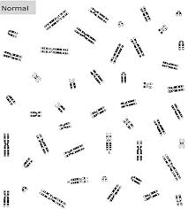 Karyotyping is the process by which photographs of chromosomes are taken in order to determine the chromosome complement of an individual. Download Karyotype Lab Write Up Answers Free Handbook 8th Vol 0 5 Android