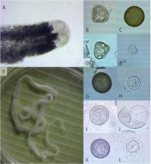 How to naturally get rid of them. Examples Of Cyclophyllidean Tapeworms And Eggs Recovered From Apodemus Download Scientific Diagram