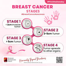 Image result for Breast Cancer Staging