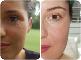 Celluspa Skin Esthetics Institute Gesicht Haut Diab