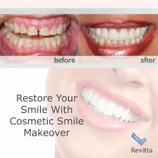 Pin On Cosmetic Dentistry