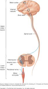 Image result for Neurologic Lesion Localization