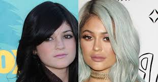 Anna is a communication expert and a life enthusiast. Kylie Jenner S Plastic Surgery Timeline Before And After Those Famous Lips Heat Amp Heatworld Com Scoopnest