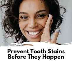 Eden Baluyot Vincent, DMD