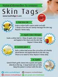 How To Remove Skin Tags Yourself Naturally Skin Tag Removal Skin Tag Oils For Skin