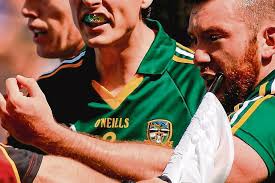 Dublin player bit Burke