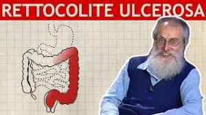 Uno stato di colite particolarmente acuto può beneficiare della sospensione dell'alimentazione per bocca (ovviamente per periodi. Dott Mozzi Rettocolite Ulcerosa E Morbo Di Crohn Youtube