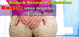 Aku seperti ingin memacari ibu, meminagnya dan akhirnya menikah. Buasir Semasa Mengandung Dan Selepas Bersalin Risiko Dan Rawatan Info Kesihatan Khaki Pants Info Khaki