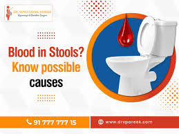 Image result for Blood in stool