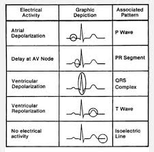 Ekg Reading Cardiac Nursing Nurse Nursing School