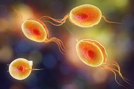 Trichomoniasis Trichomonaden Infektion Ursachen Beschwerden Therapie Gesundpedia De