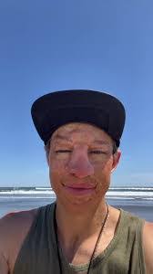 James Burn's Instagram, Twitter & Facebook