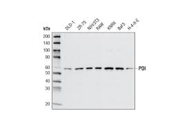 The pain disability index (pdi) overview: Pdi C81h6 Rabbit Mab