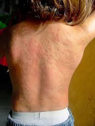 Ngobrol dengan teman sekantor juga bisa jadi salah satu cara menghilangkan rasa ngantuk yang menyenangkan. Apakah Itu Gegata Kelab Soal Jawab Ibu Bakal Ibu Comel Facebook