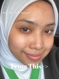 HOW TO MANAGE OIL ON FOOD