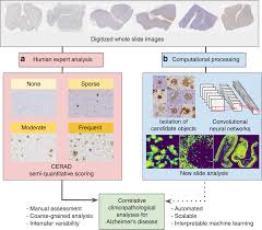 Interpretable Classification Of Alzheimers Disease