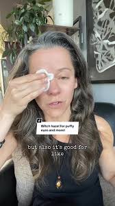 What Does It Mean When Witch Hazel Burns Your Face