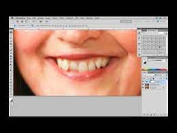 How To Fix Crooked Teeth In Photoshop Tutorial Youtube Photoshop Tutorial Photoshop Photo Tips