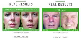 Bianca Meoli (@BiancaMeoli)