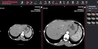 Check spelling or type a new query. Dicomlibrary Share View Dicom Files With An Advanced Online Viewer