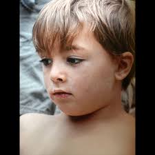 ⚽️: MT SURF a 501(c)3