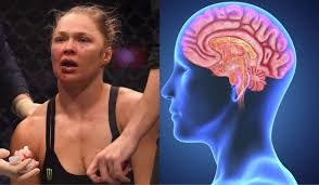 Cte stands for common table expression. Cte The Ufc And The Dark Side Of Combat Sports