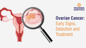 Ovarian cancer can occur in numerous different parts of the ovary. Ovarian Cancer Early Signs Detection And Treatment