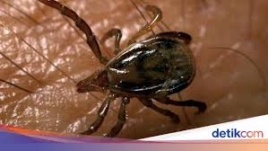 Gigitan kutu sering terjadi karena hewan ini dapat dengan mudah berpindah di antara manusia dan hewan lain. Kecil Kecil Berbahaya 5 Kutu Yang Bisa Sebabkan Masalah Kesehatan