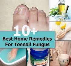 What Is The Best Home Remedy For Toenail Fungus Nail Fungus Treatment Nail Fungus Remedy Home Remedies
