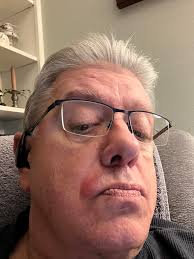 Does Anyone have an issue like this ? Started about a month ago, doesn't  matter what Razor, Soap, Balm or Splash, just gets bright red