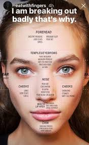 Pin By Katelyn Ballentine On Health Face Mapping Acne Face Acne Homemade Acne Treatment