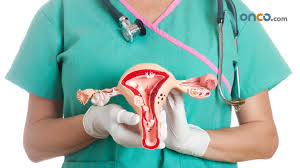 Stage 3 Ovarian Cancer Onco Com